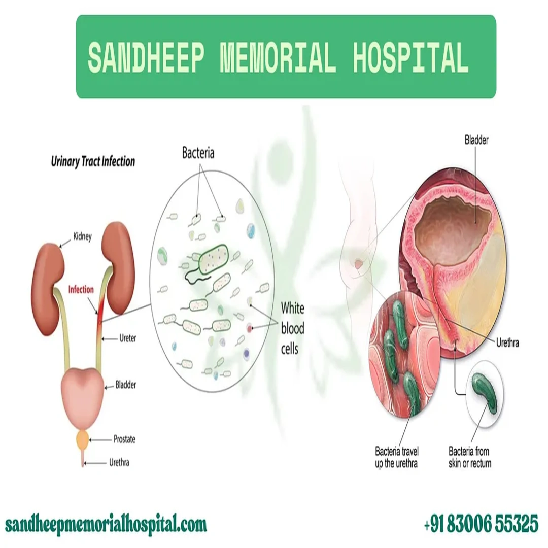 சிஸ்டிடிஸ் குறித்த உண்மையை புரிந்துகொள்வோம் (Urinary Tract Infection — UTI)