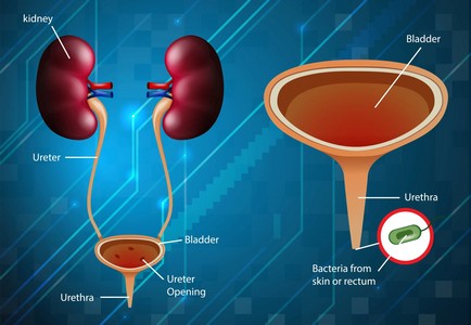 Laparoscopic-Urology-Treatment- in-Madurai